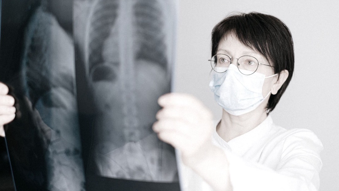 《中国成人原发性肝癌经动脉化疗栓塞(TACE)联合系统抗肿瘤治疗专家共识（2026版）》发布，栓塞后72小时成了关键窗口