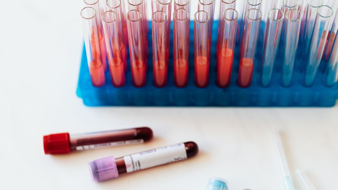 用4%股权换2.6亿美元：ToleranceBio的胸腺再生赌注